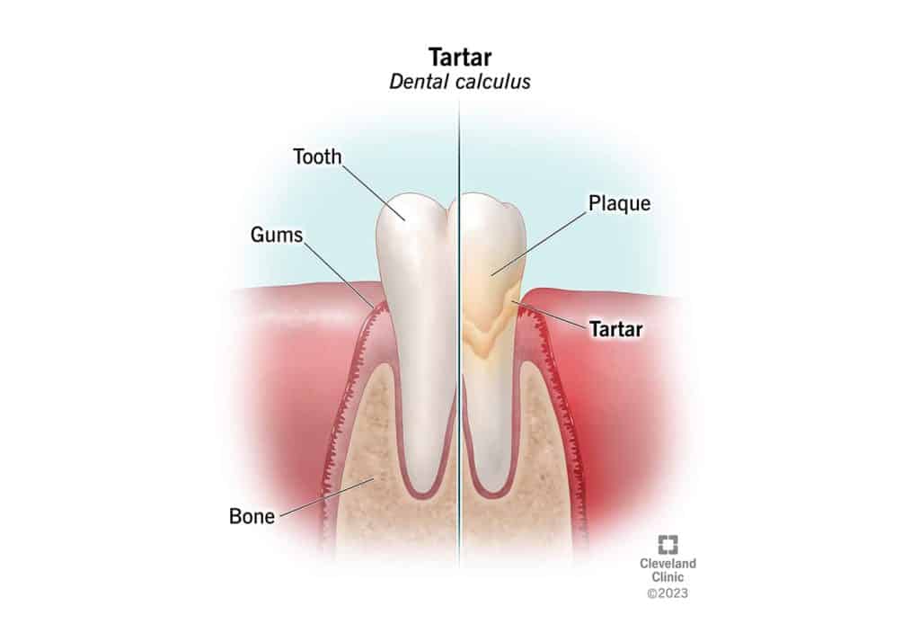 a diagram of a dog tooth